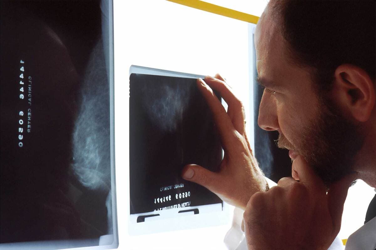 Surdiagnostic du cancer de la thyroïde : enjeux et solutions