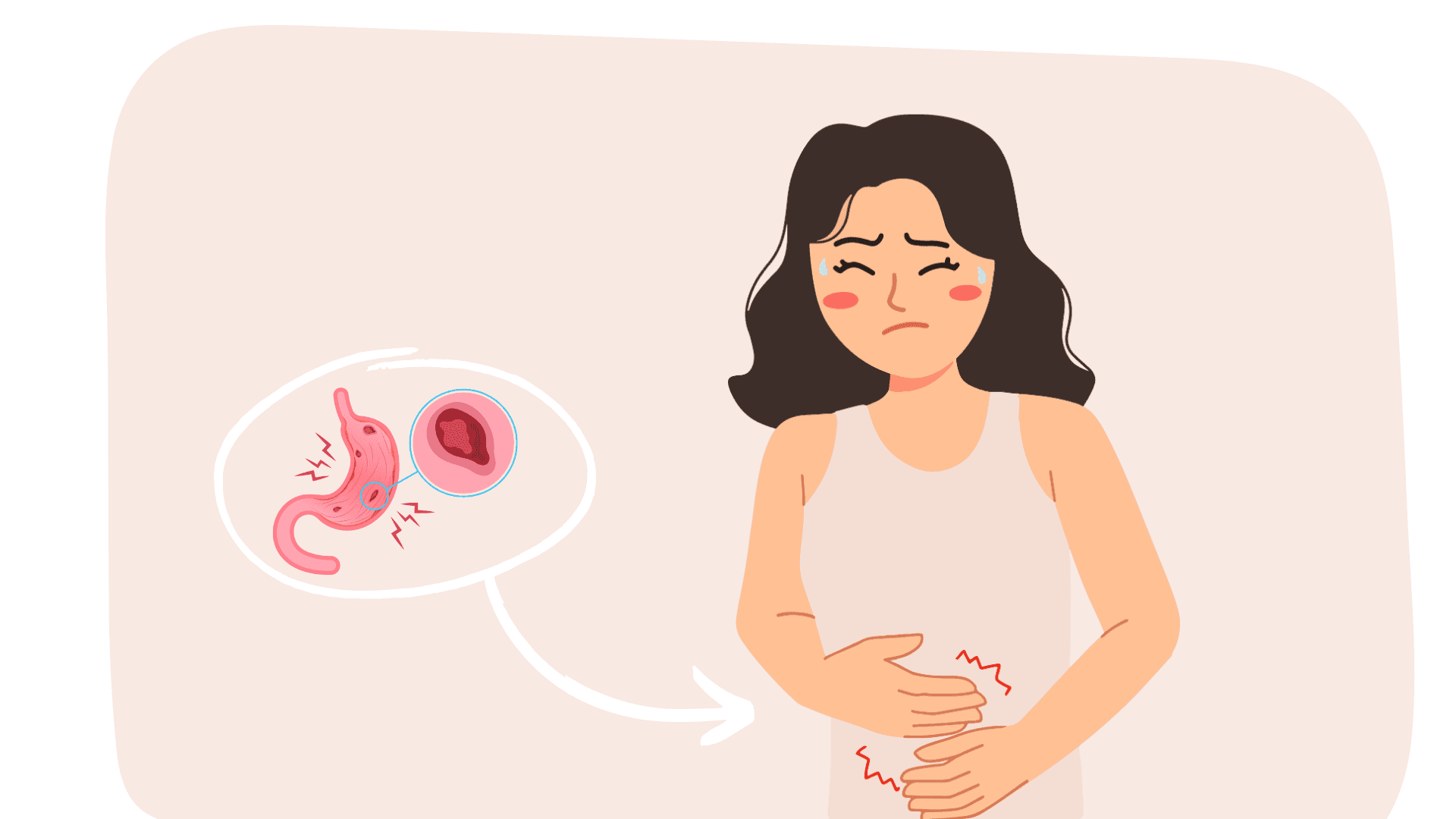 Soigner la gastro entérite : symptômes, traitements et prévention