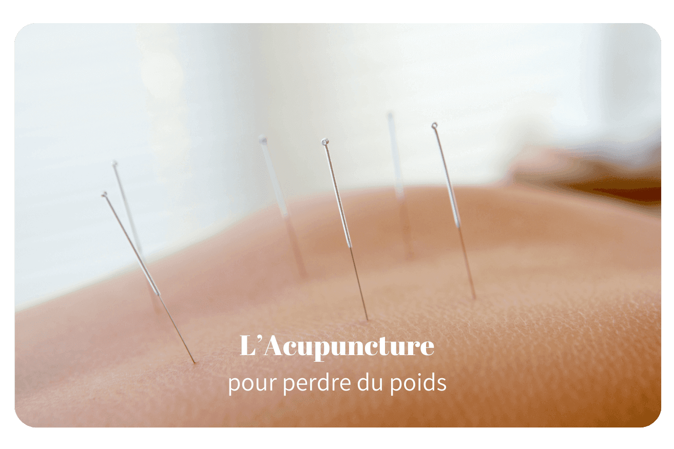 L’acupuncture pour perdre du poids