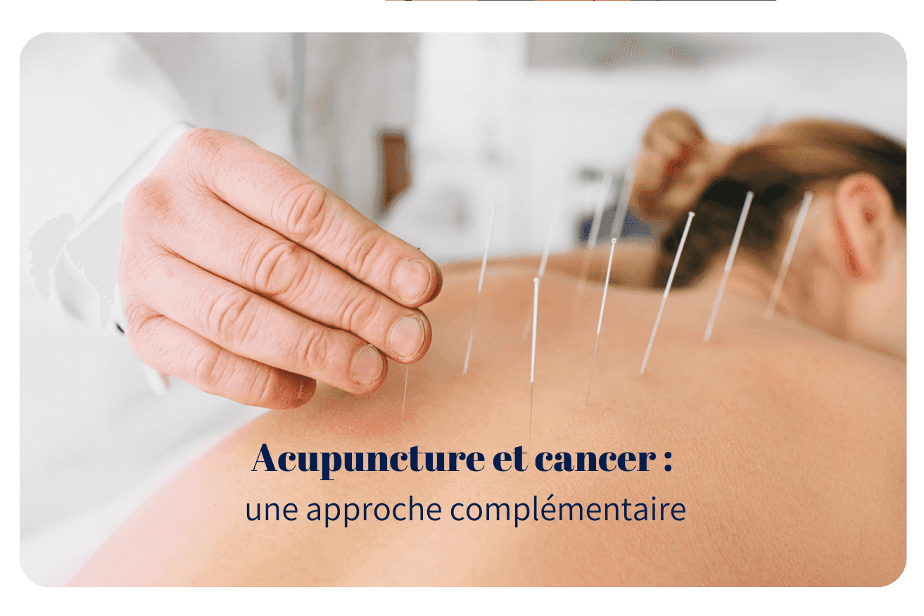 Acupuncture et cancer : une approche complémentaire
