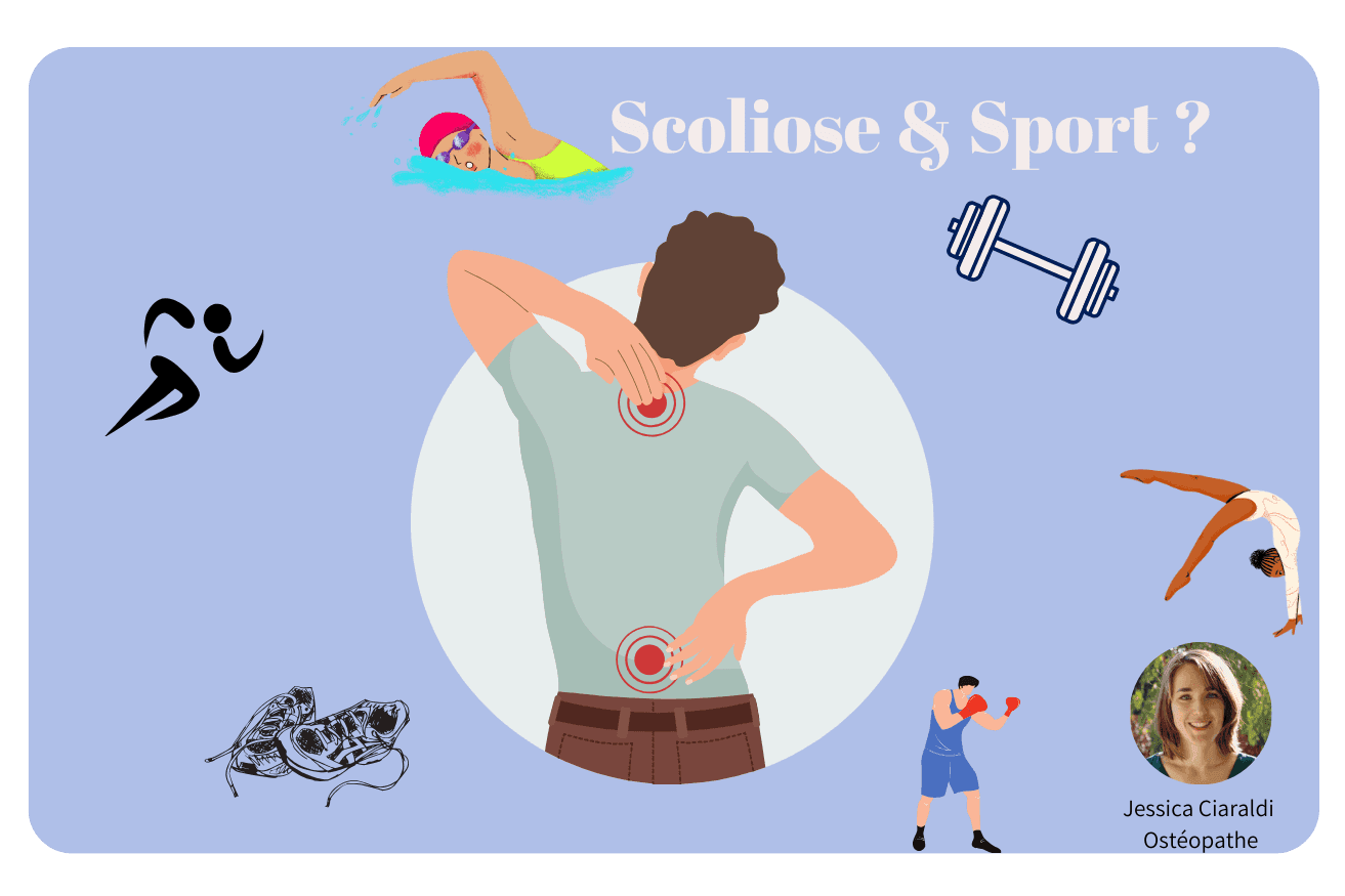 Peut-on faire du sport quand on a une scoliose ?