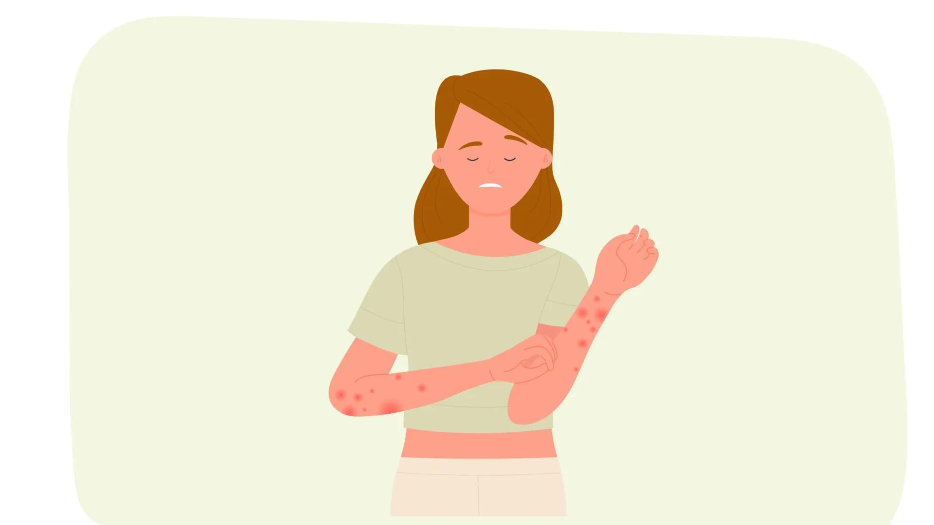 L’eczéma de contact : comprendre et apaiser cette inflammation cutanée