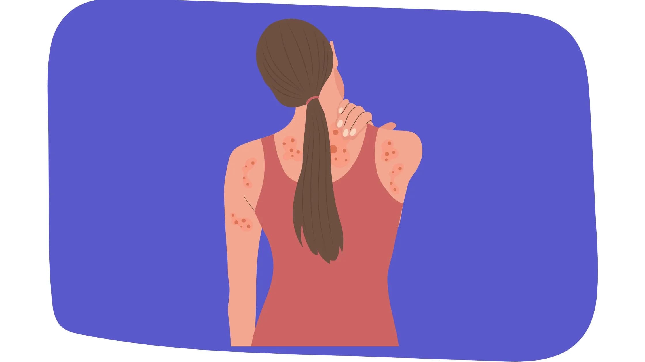 Les complications possibles de la dermatite atopique