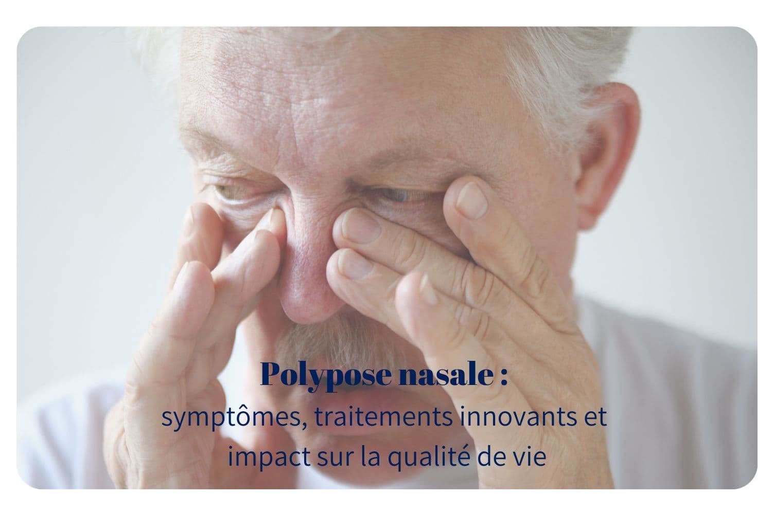 La Polypose nasale : symptômes, traitements innovants et impact sur la qualité de vie