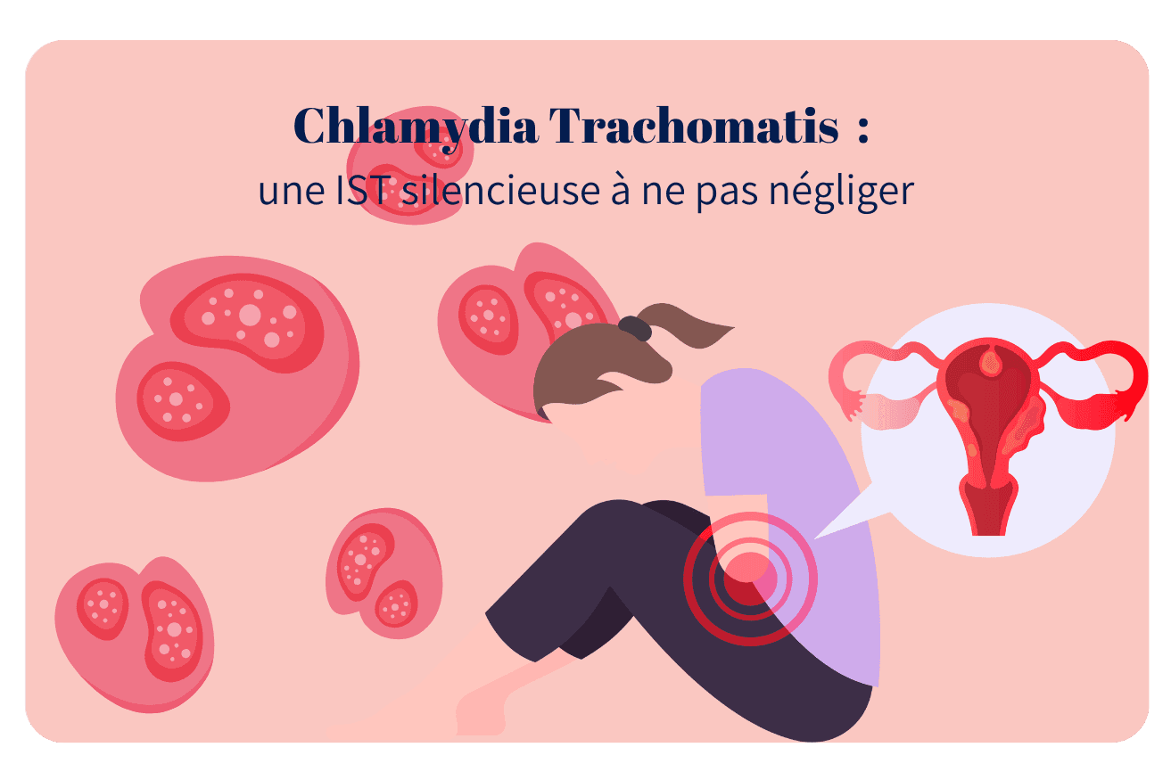 Tout savoir sur la Chlamydia Trachomatis