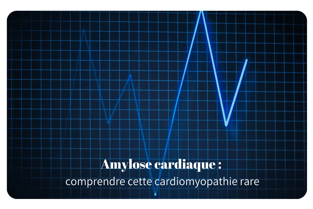 Amylose cardiaque : comprendre cette cardiomyopathie rare et ses traitements innovants