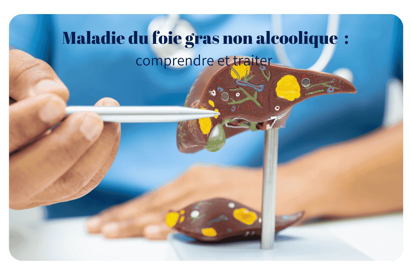 Comprendre et traiter la maladie du foie gras non alcoolique (NASH)