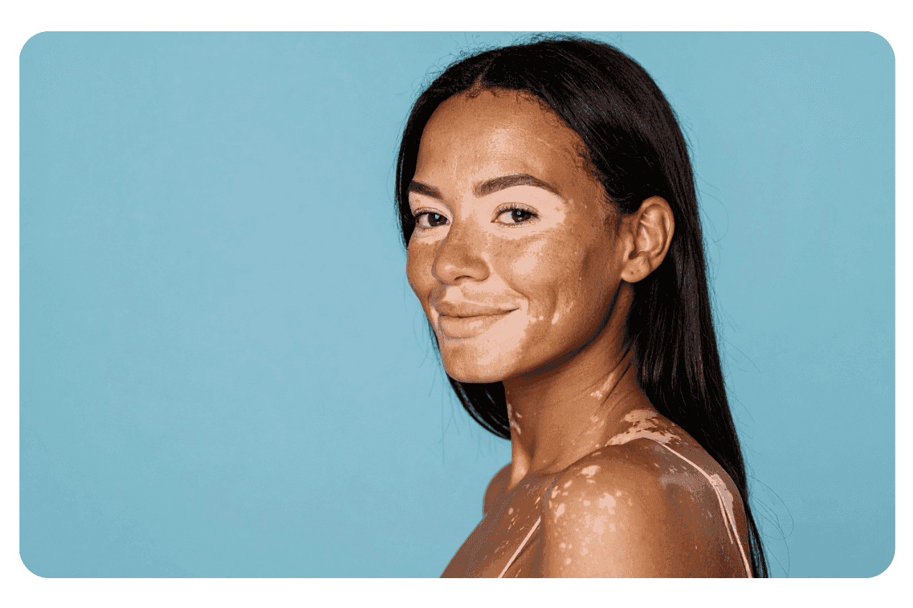Taches sur la peau : Causes, Traitements et Solutions efficaces
