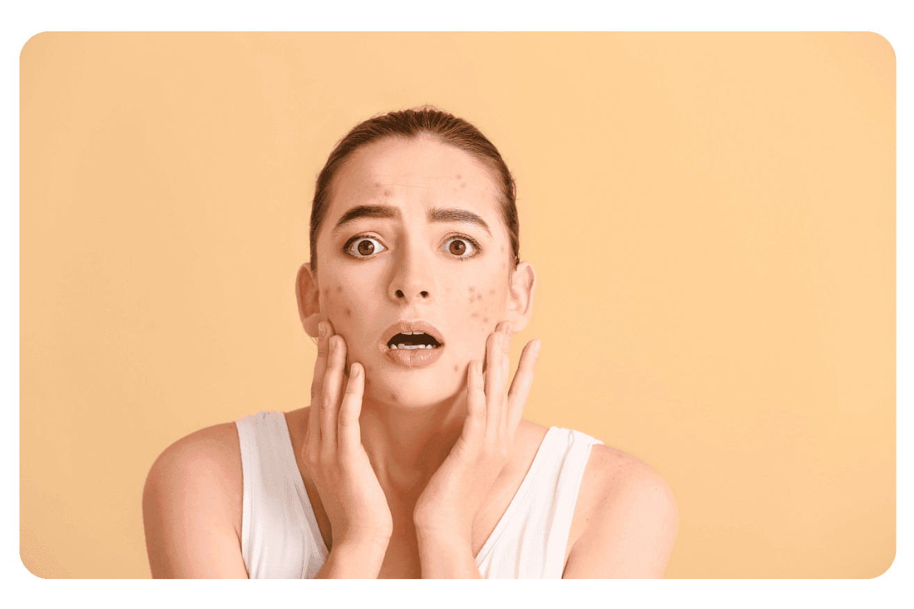 Les problèmes de peau : causes, symptômes et solutions efficaces