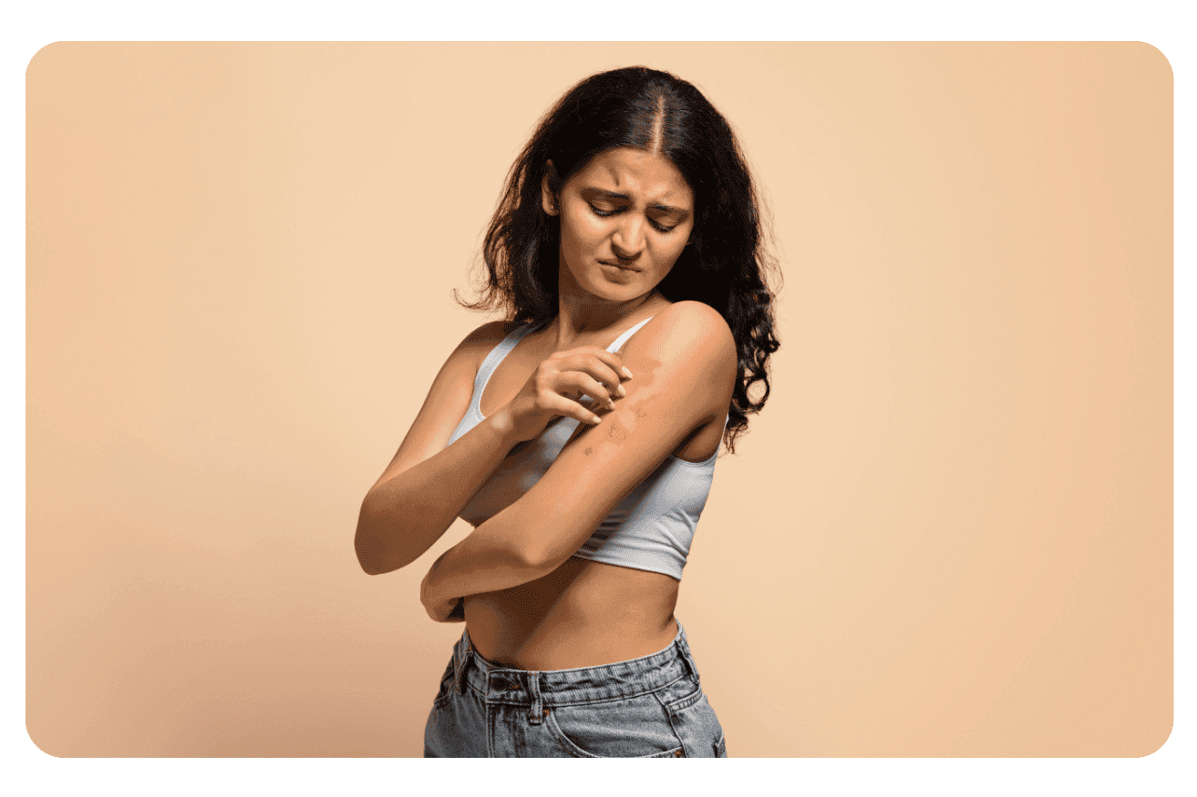 Psoriasis : Traitements efficaces et solutions naturelles pour soulager