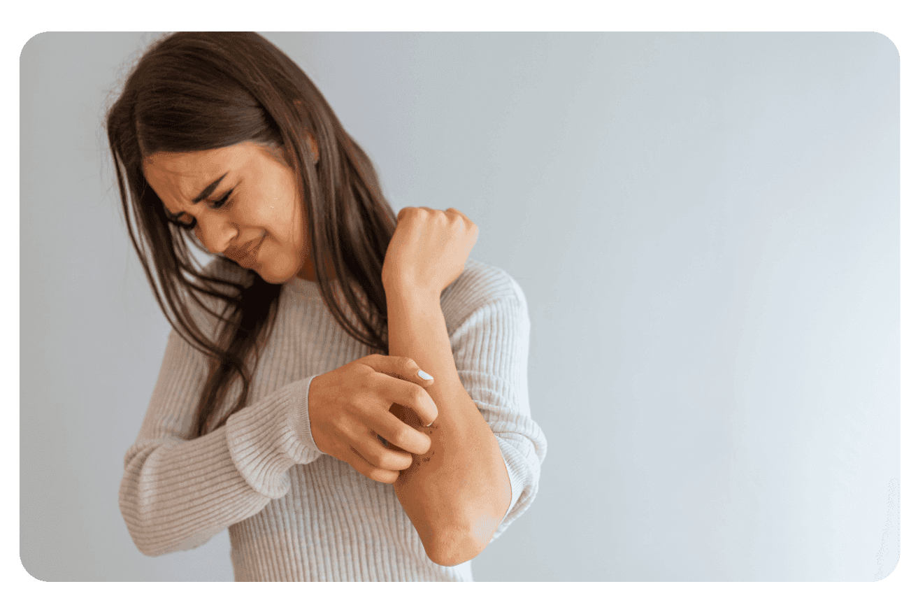 Eczéma : Traitements Efficaces et Solutions Naturelles pour Soulager les Symptômes