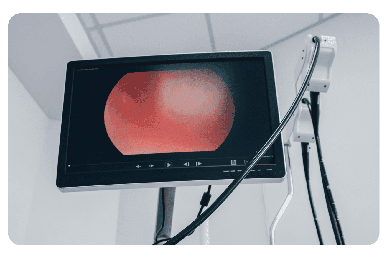 Différence entre coloscopie et endoscopie : guide complet des examens digestifs