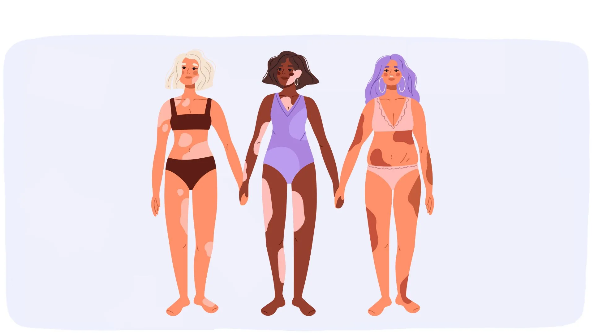 Symptômes et traitements du Vitiligo