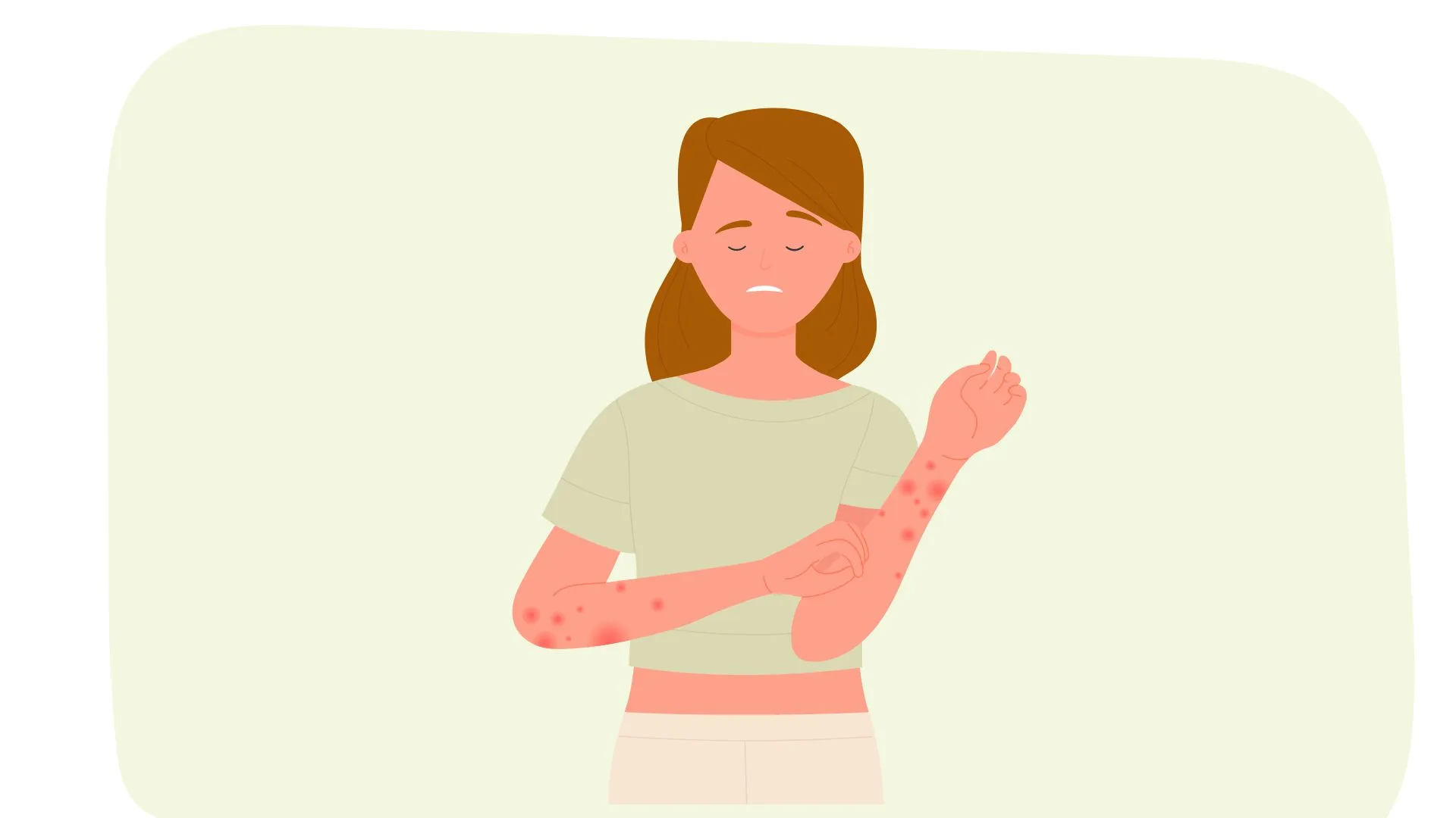 L’eczéma de contact : comprendre et apaiser cette inflammation cutanée